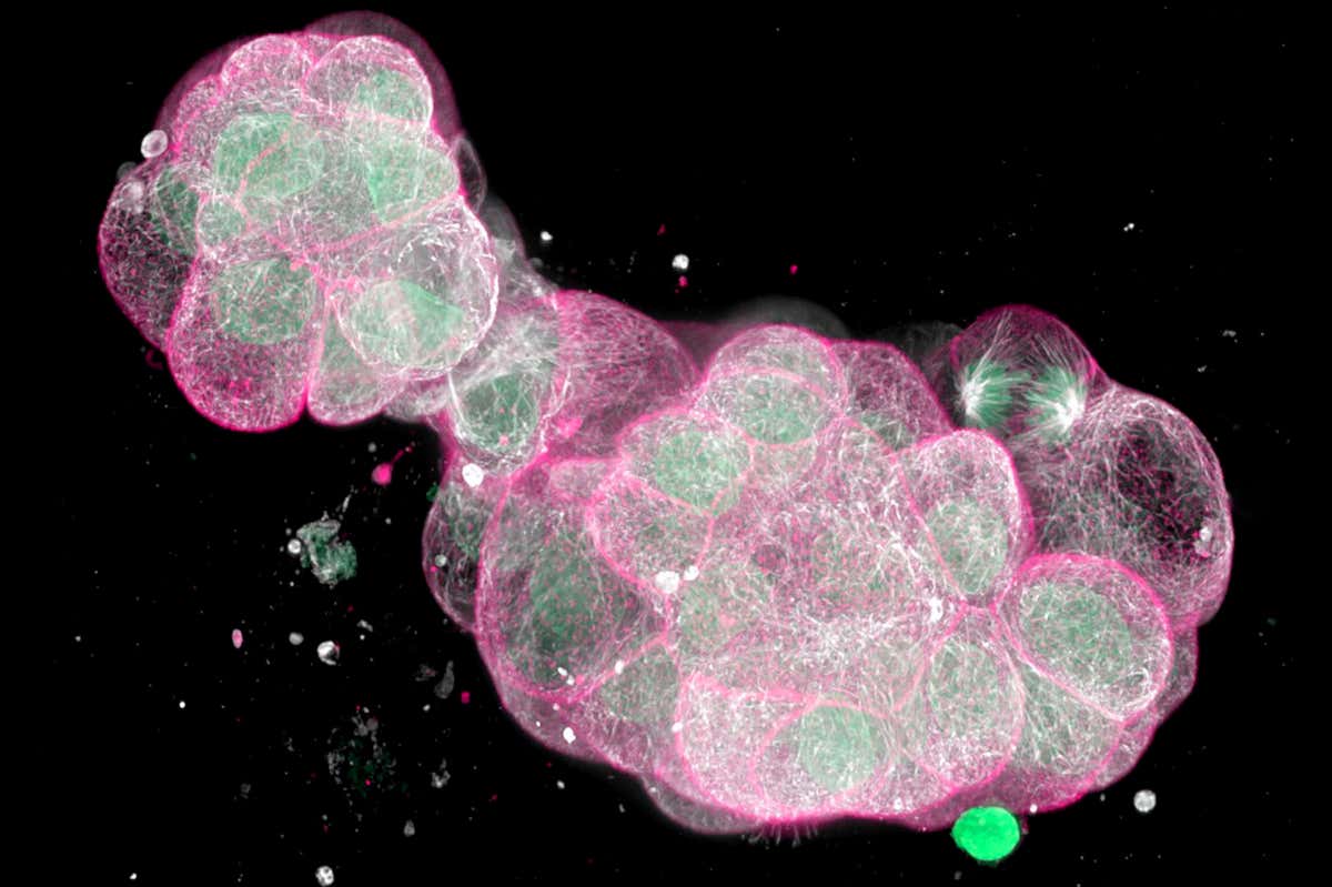 Micrograph of human colon cancer cells in a three-dimensional extracellular matrix